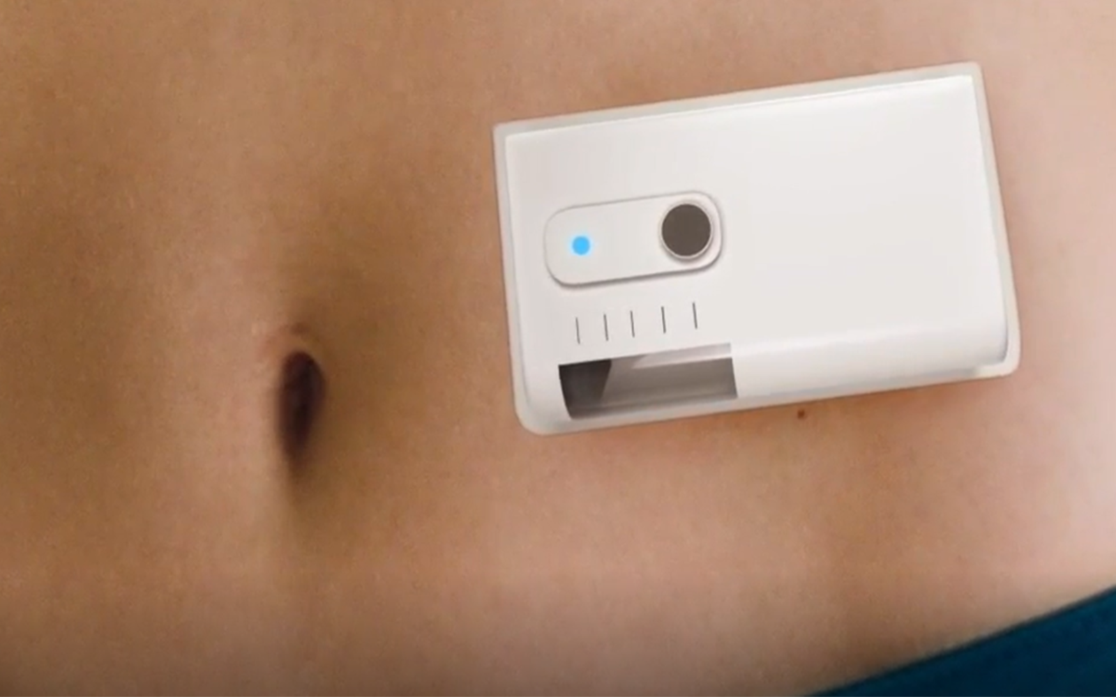 When Size Matters: Evolution of Self-Delivery Solutions for Subcutaneous Administration